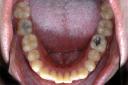 Vista oclusal inferior